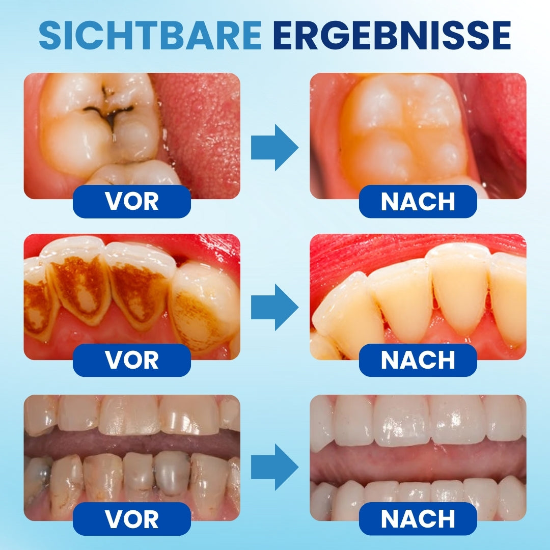 AEXZR® Postbiotisches Zahnschmelz-Serum 🧬 Nano-Reparatur für Mikroschäden & Empfindliche Zähne