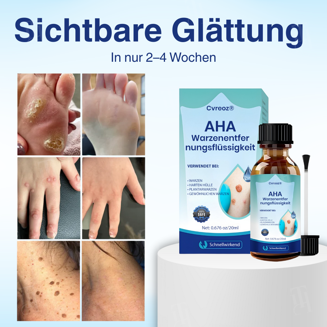 🌟 Offizieller Shop | Cvreoz® AHA Warzenentfernungsflüssigkeit