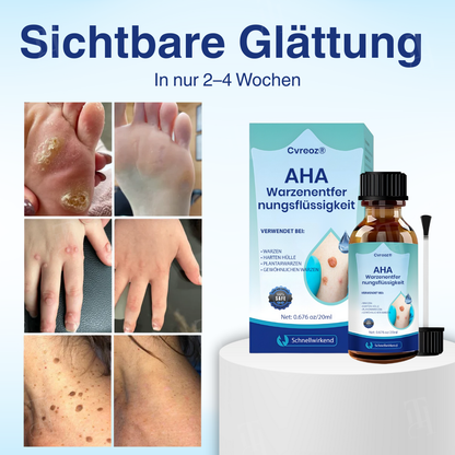 🌟 Offizieller Shop | Cvreoz® AHA Warzenentfernungsflüssigkeit