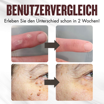 🌟 Offizieller Shop | Cvreoz® All-in-1 Ceramide Hautcreme