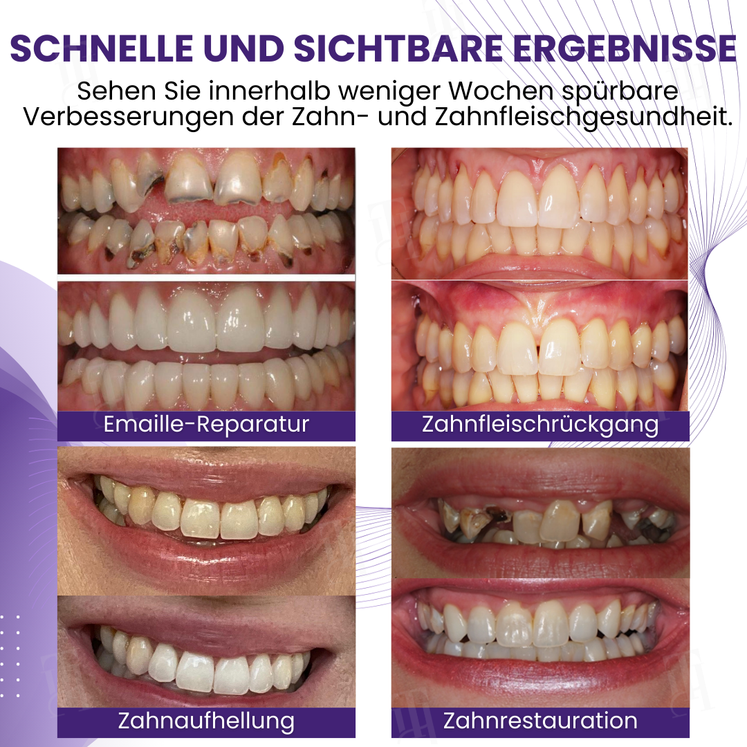 🌟 Offizieller Shop | AEXZR® Smileagain Bienengift Orales Behandlungspulver