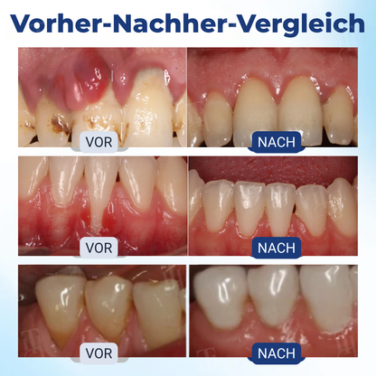 🌟 Offizieller Shop| RZXEA™ Postbiotics Bee Gumcare-Lösung
