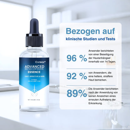 🌟 Offizieller Shop | Cvreoz®  Fortgeschrittene Essenz gegen Hautanhängsel & Warzen