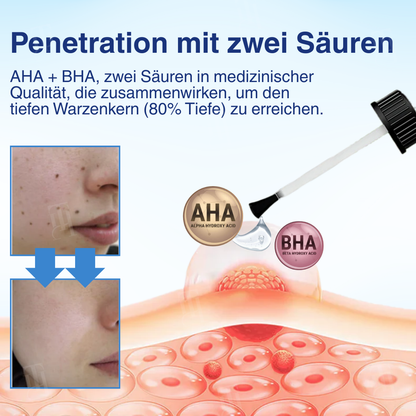 🌟 Offizieller Shop | Cvreoz® AHA Warzenentfernungsflüssigkeit