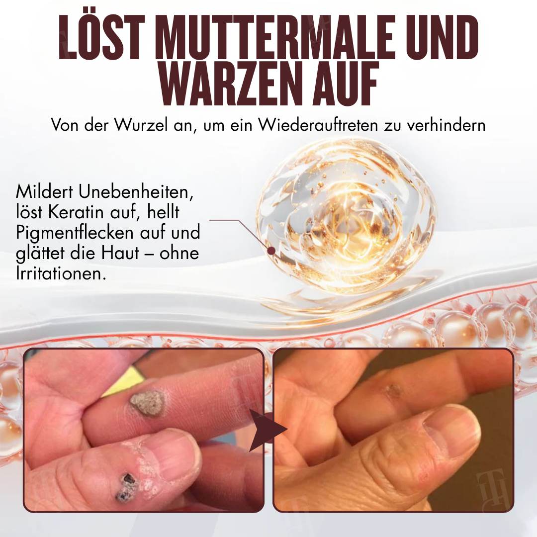 🌟 Offizieller Shop | Cvreoz® All-in-1 Ceramide Hautcreme