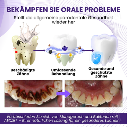 🌟 Offizieller Shop | AEXZR® Smileagain Bienengift Orales Behandlungspulver