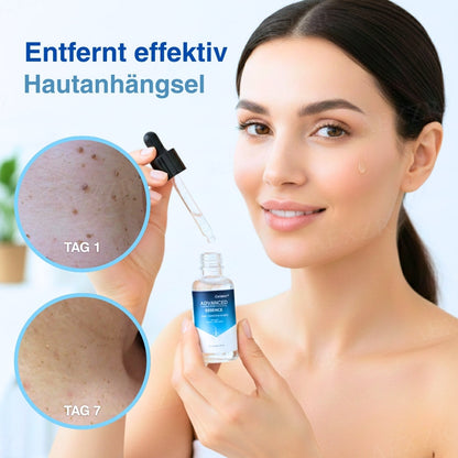 🌟 Offizieller Shop | Cvreoz®  Fortgeschrittene Essenz gegen Hautanhängsel & Warzen