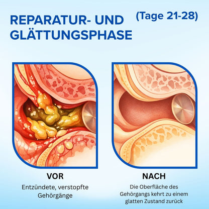 🌟 Offizieller Shop | AEXZR® Squalan-Ohrreinigungs-Tropfen