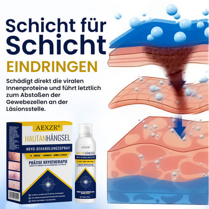 🌟 Offizieller Shop | AEXZR® Hautanhängsel-Kryo-Behandlungsspray