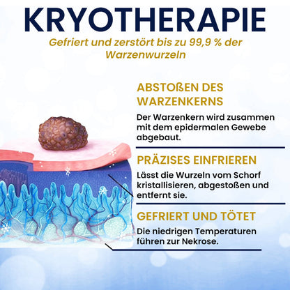🌟 Offizieller Shop | AEXZR® Hautanhängsel-Kryo-Behandlungsspray