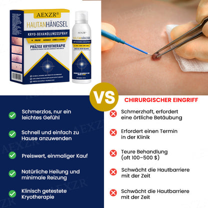🌟 Offizieller Shop | AEXZR® Hautanhängsel-Kryo-Behandlungsspray